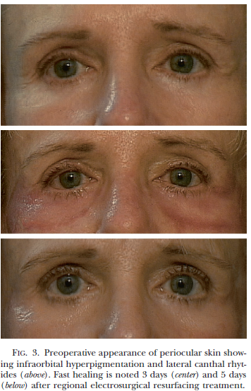 화면 캡처 2025-03-15 170548.png