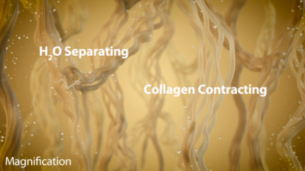 써마지 원리2.png