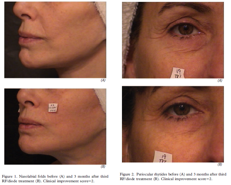 화면 캡처 2025-03-17 173528.png