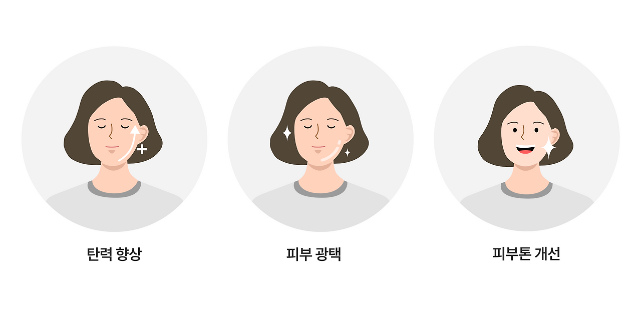 V라인 리프팅_5.png