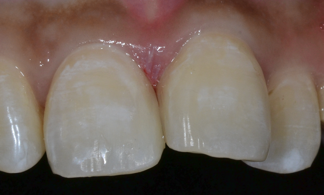 스크린샷 2023-09-08 154928.png