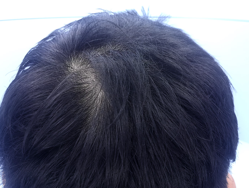 내 뒤통수 250329.png