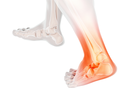 브런치 발목 통증.png