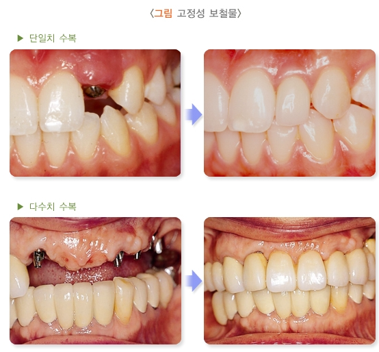 스크린샷 2024-10-31 234752.png