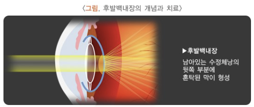 스크린샷 2024-06-25 004021.png