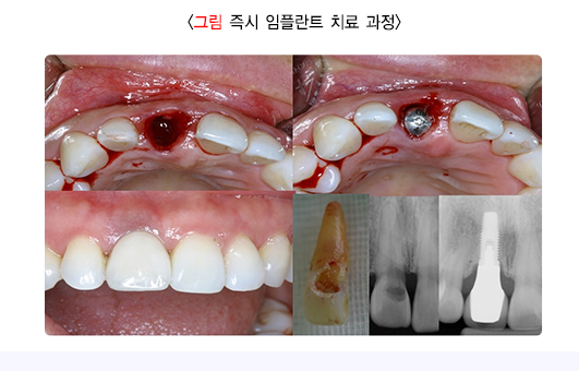 스크린샷 2024-10-31 234758.png