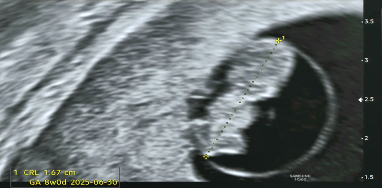 7주0일 몸길이.png