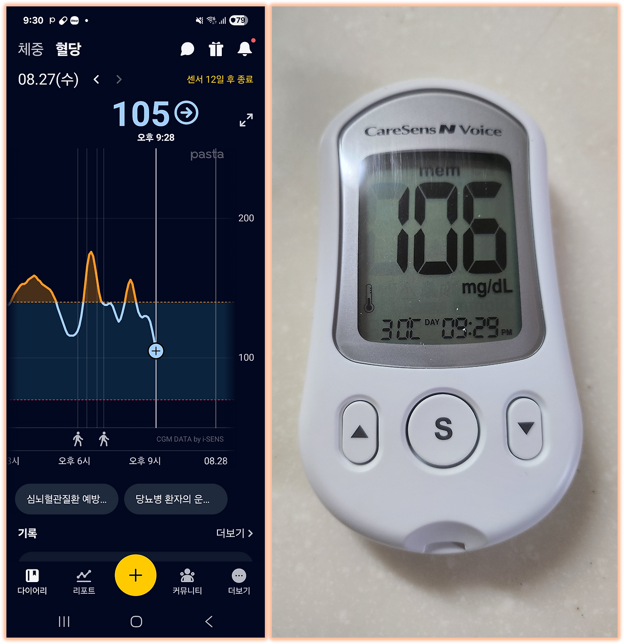 케어센스 보정.png