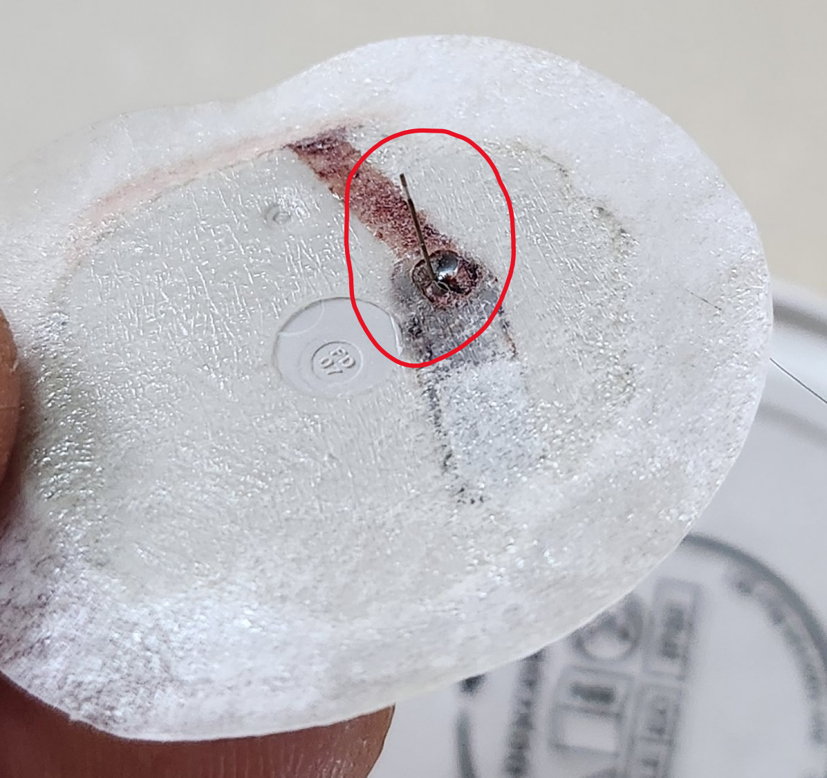 Dexcom 센서 바늘모습.png