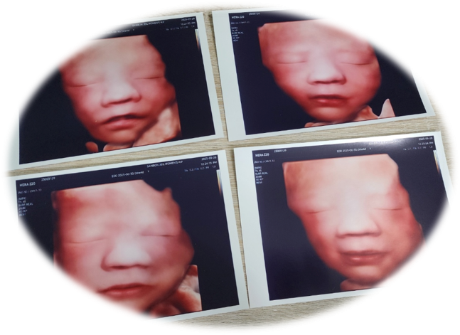 연우 입체사진.png