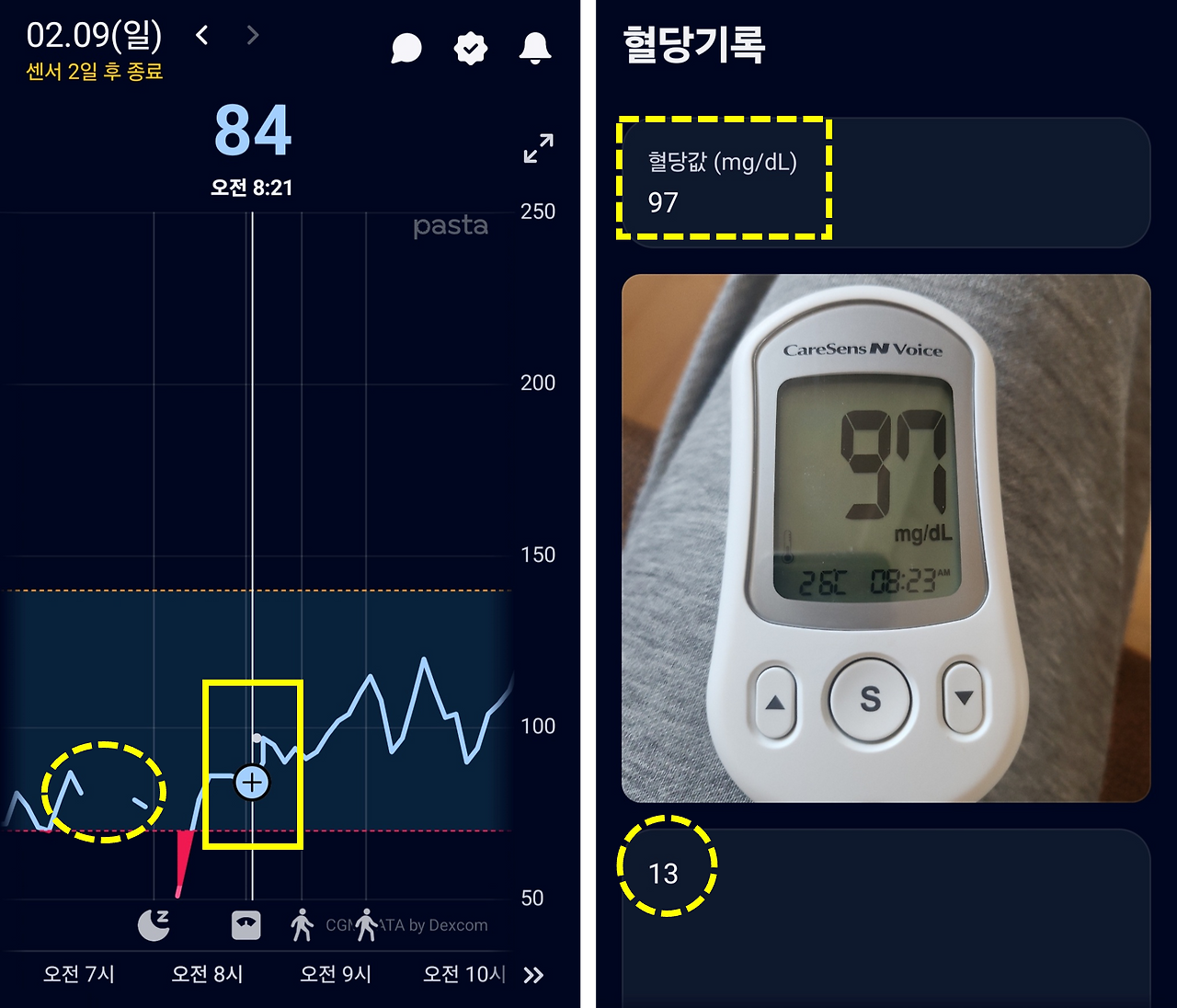센서 이상 및 보정.png