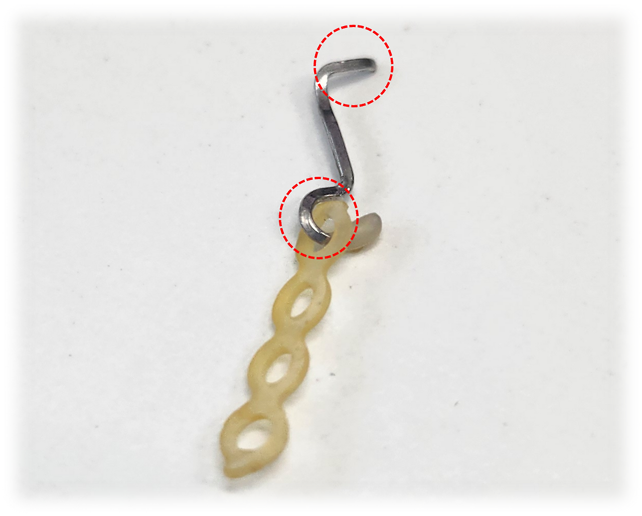 교정장치 파손1.png