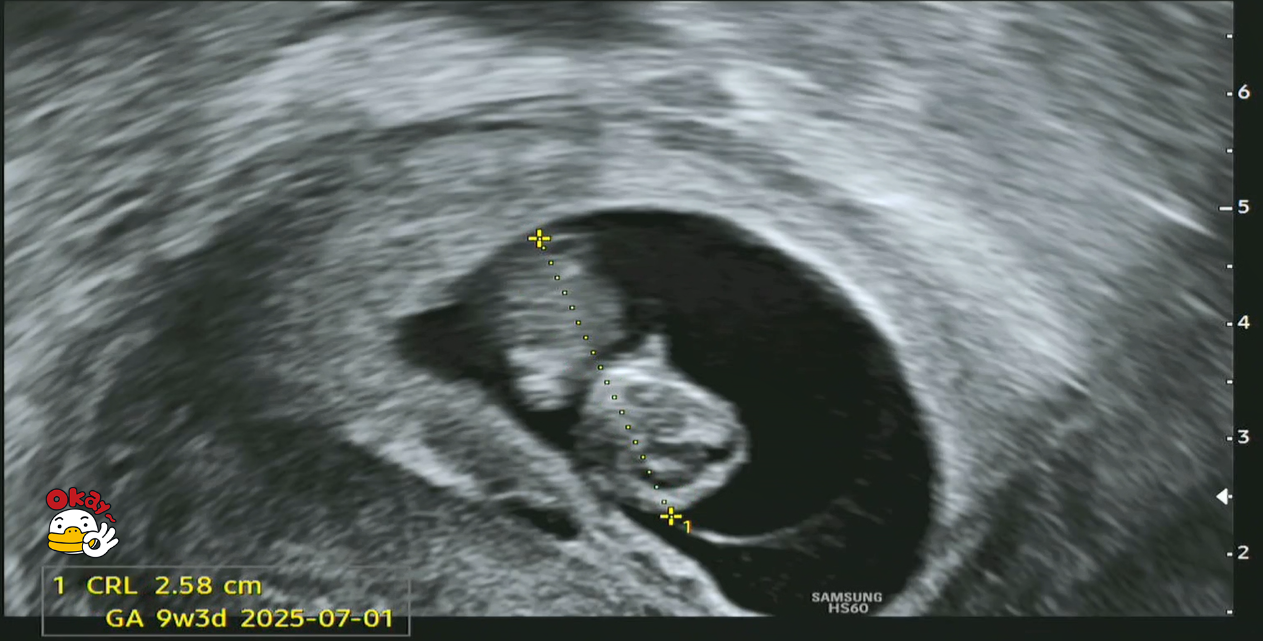 9주차 태아 크기.png