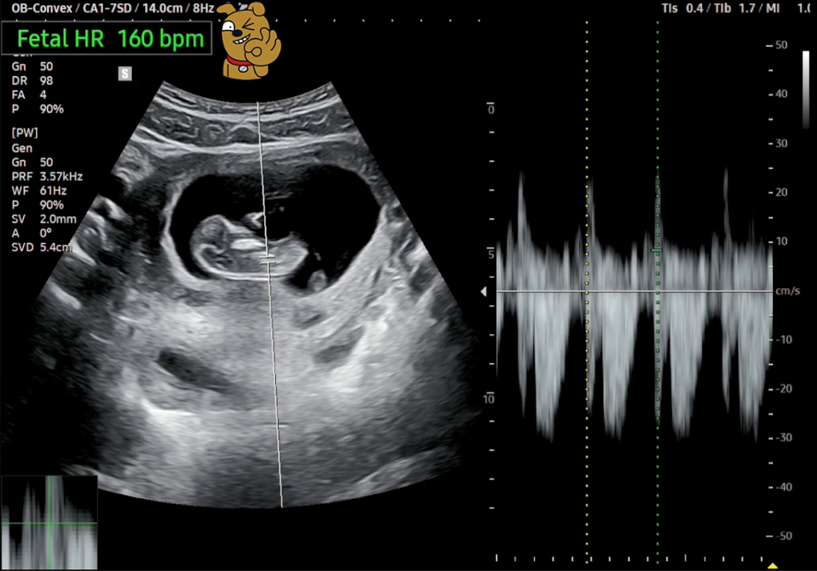 10주 심장박동수.png