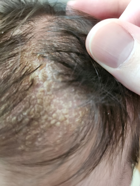 머리 지방관.png