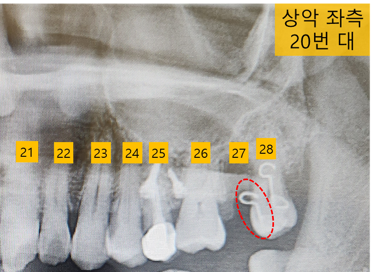 파노라마 사진_교정 떨어짐.png