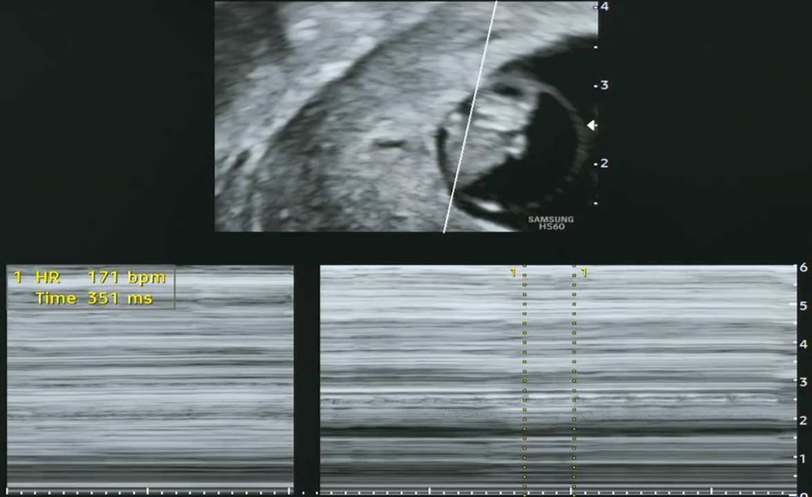 7주0일 심박수.png