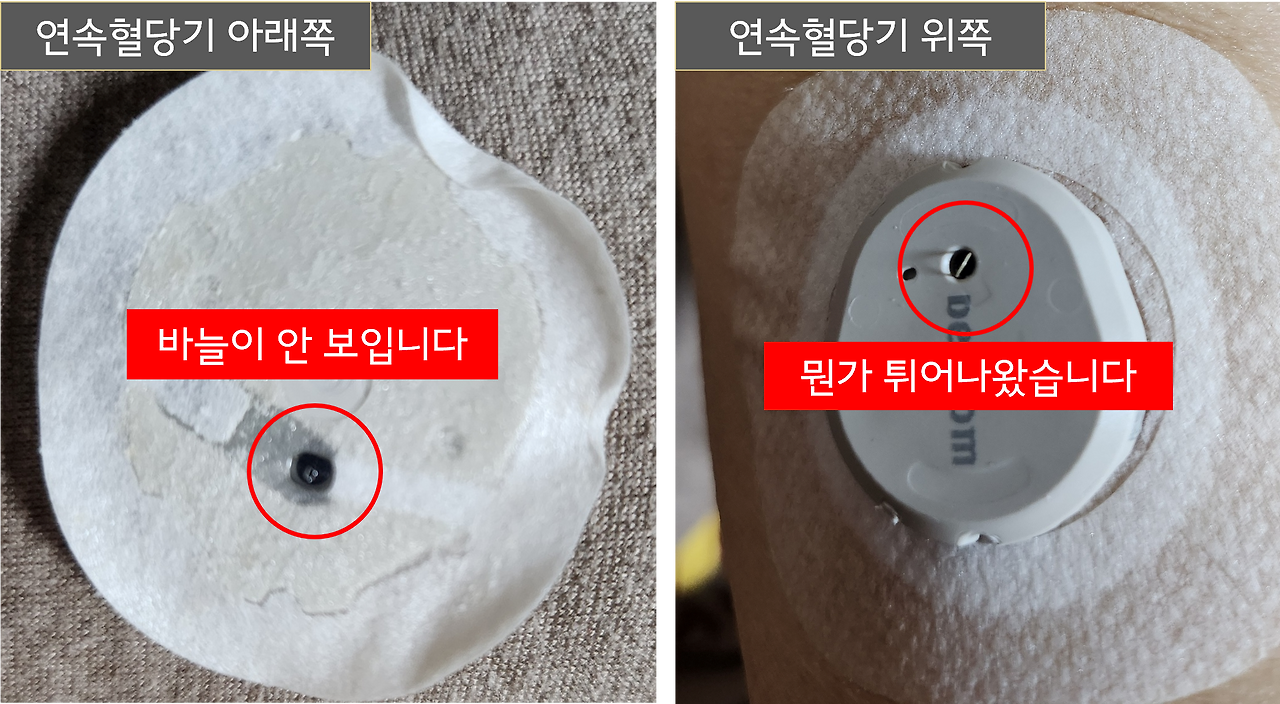 덱스콤 센서 고장 3.png