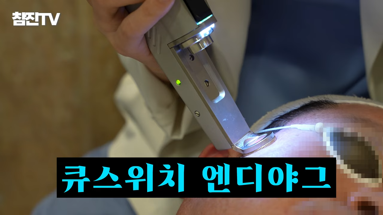 검버섯, 흑자 없애는 방법 공개! 영상 하나로 정리해드립니다! #흑자제거 #검버섯 #여드름흉터 4-51 screenshot.png