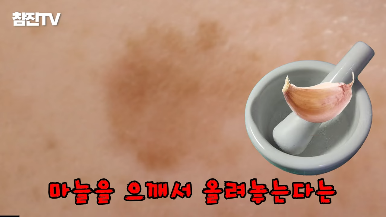 검버섯, 흑자 없애는 방법 공개! 영상 하나로 정리해드립니다! #흑자제거 #검버섯 #여드름흉터 3-55 screenshot.png