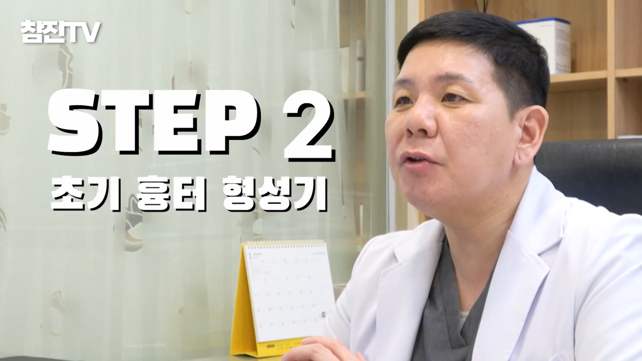 여드름 흉터 치료 늦으면 절대 안됩니다! 골든타임 절대 지켜!! #여드름흉터 #한의원 #여드름흉터한의원 1-21 screenshot.png