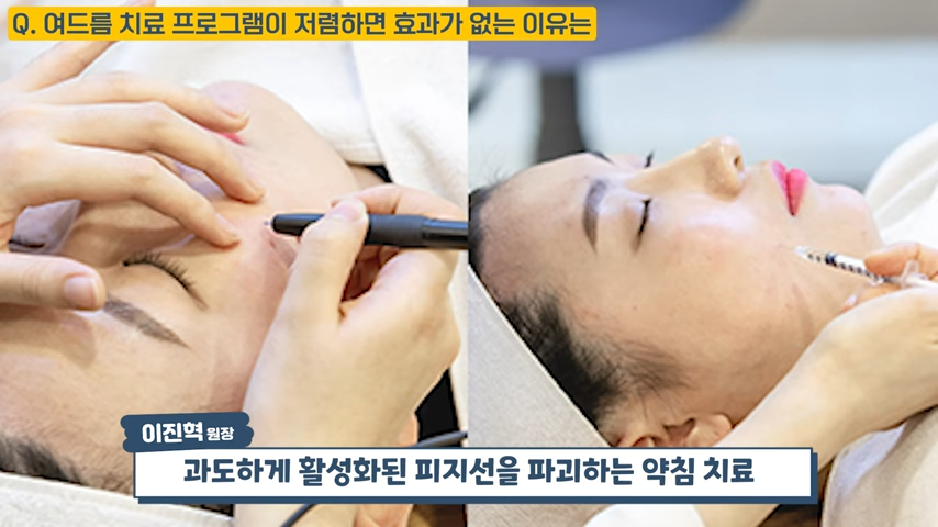 난치성 여드름 치료가 저렴할 수 없는 이유, 여드름 치료 비용 대공개 #난치성여드름 #화농성여드름 #여드름전문한의원 2-29 screenshot.png