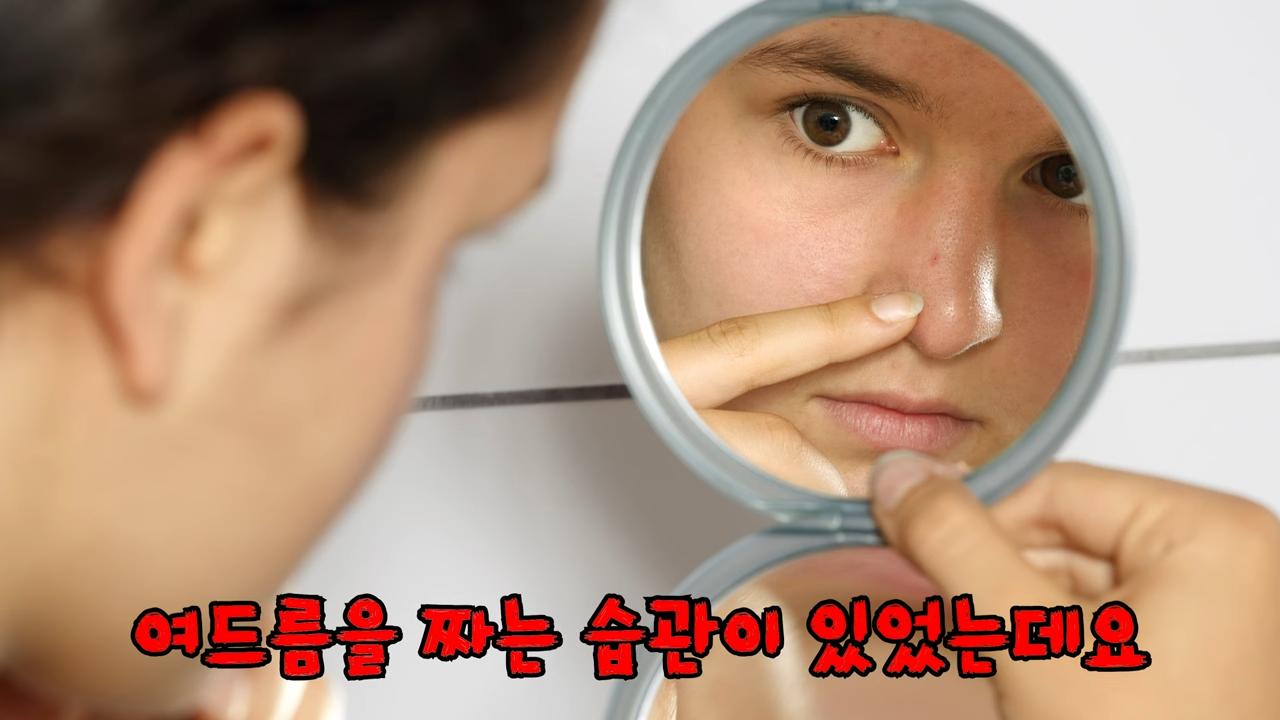 여드름치료 실패 사례� #여드름흉터 #흉터치료 #skincare 1-46 screenshot.png