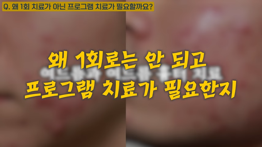 난치성 여드름 치료가 저렴할 수 없는 이유, 여드름 치료 비용 대공개 #난치성여드름 #화농성여드름 #여드름전문한의원 0-40 screenshot.png