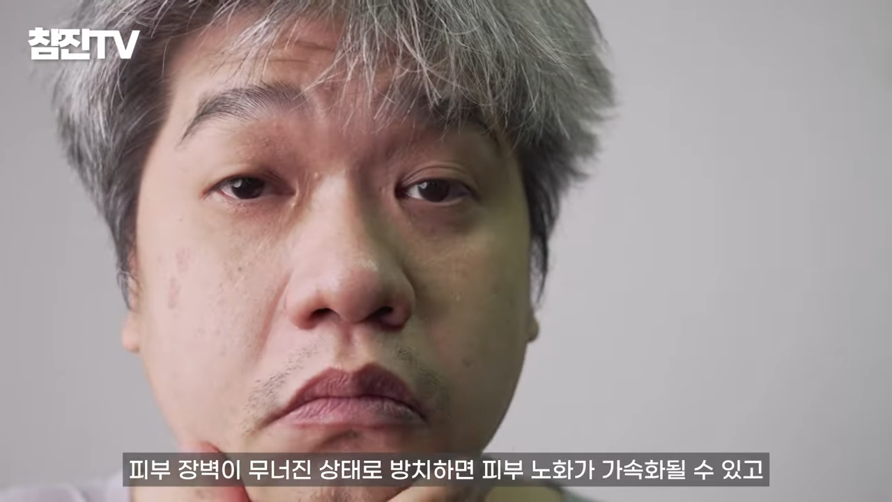 흑백요리사 (_) 백수저 한의사의 환절기 피부에 좋은 음식 추천 #흑백요리사 #흑백 #여드름압출 0-55 screenshot.png