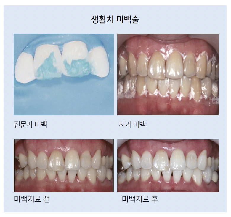 스크린샷 2024-03-25 오후 5.23.23.png