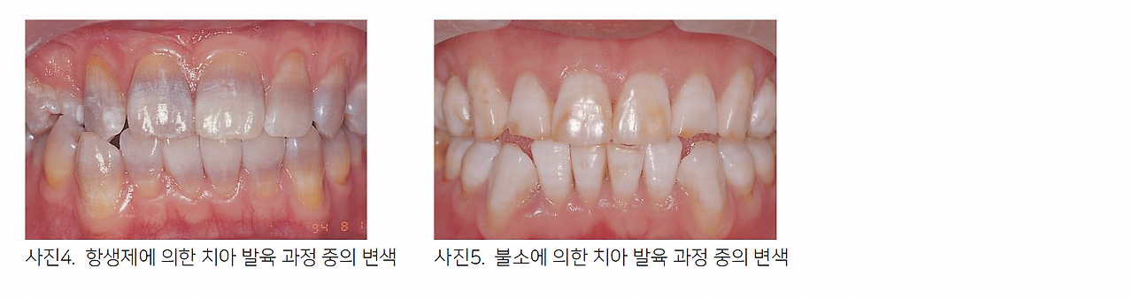 스크린샷 2024-03-25 오후 5.20.20.png