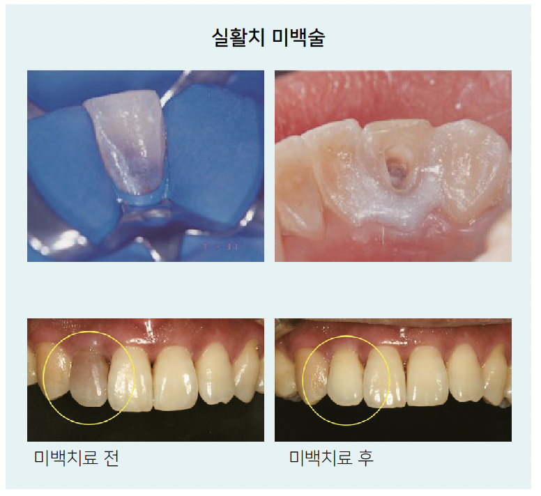 스크린샷 2024-03-25 오후 5.23.19.png