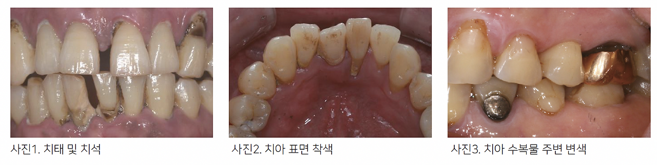 스크린샷 2024-03-25 오후 5.17.59.png