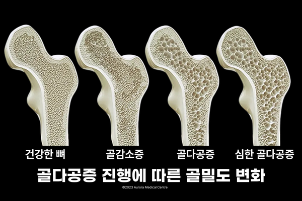 블로그삽입이미지2 202410~.png