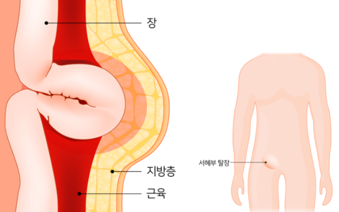 화면 캡처 2025-03-03 132804.png