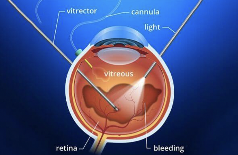 스크린샷 2025-09-02 오후 4.43.52.png