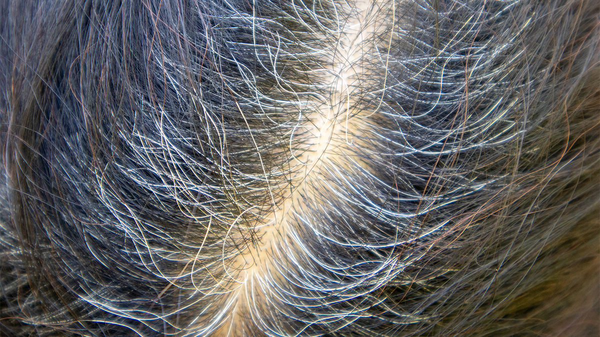 lot of gray hair.png