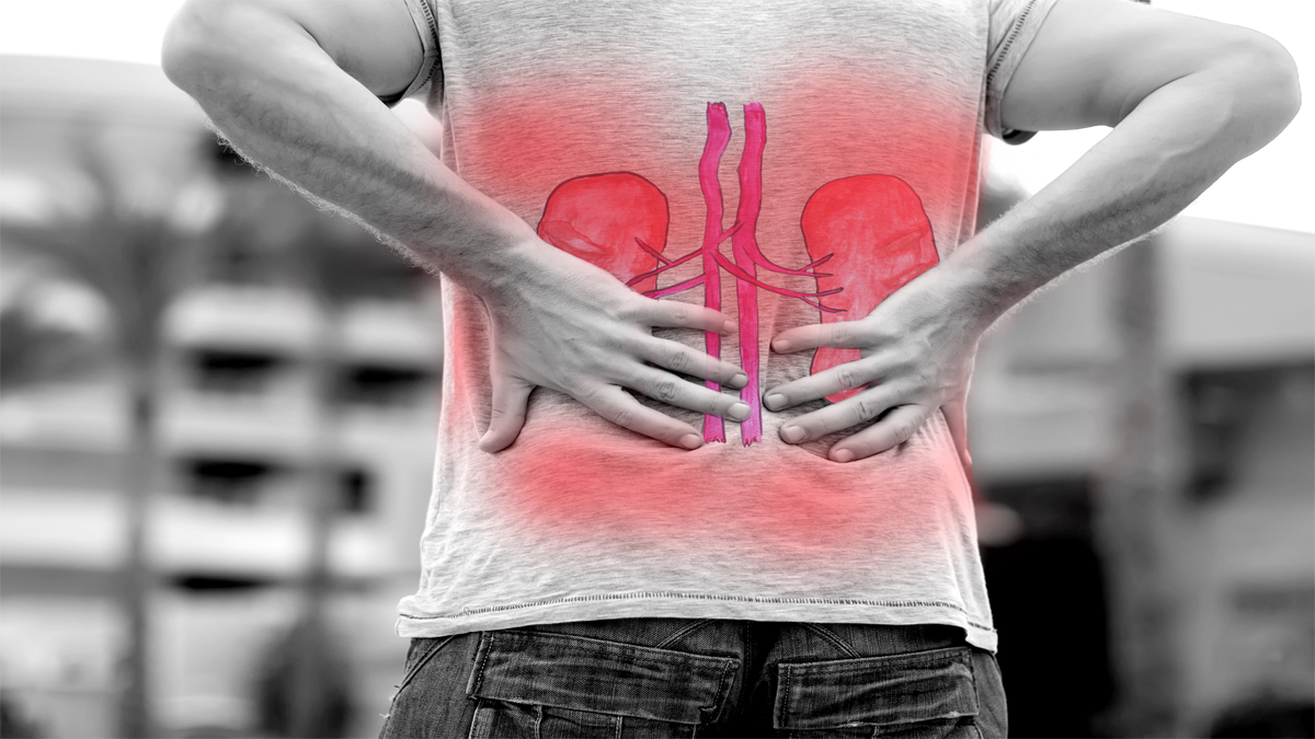 kidney strain.png