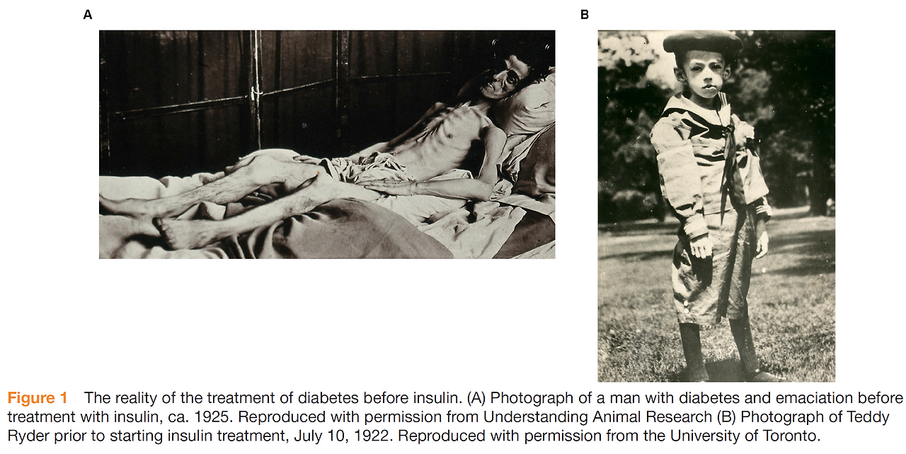 starvation tx befor insulin.png