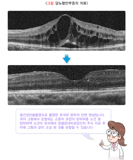 treatment result.png