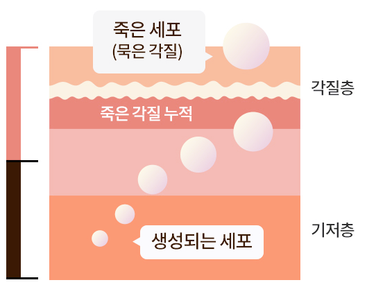 각질.png