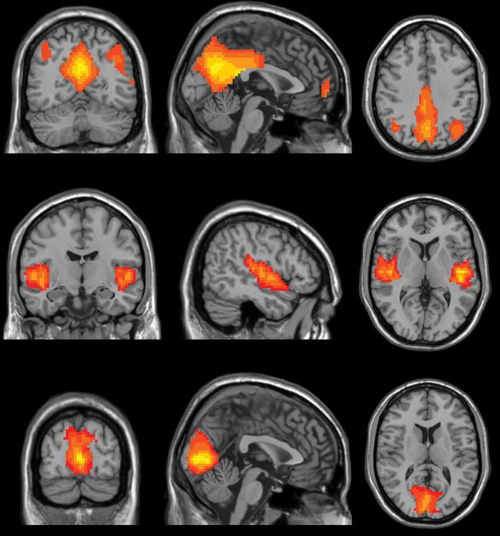 Fig3_resting state fMRI.png