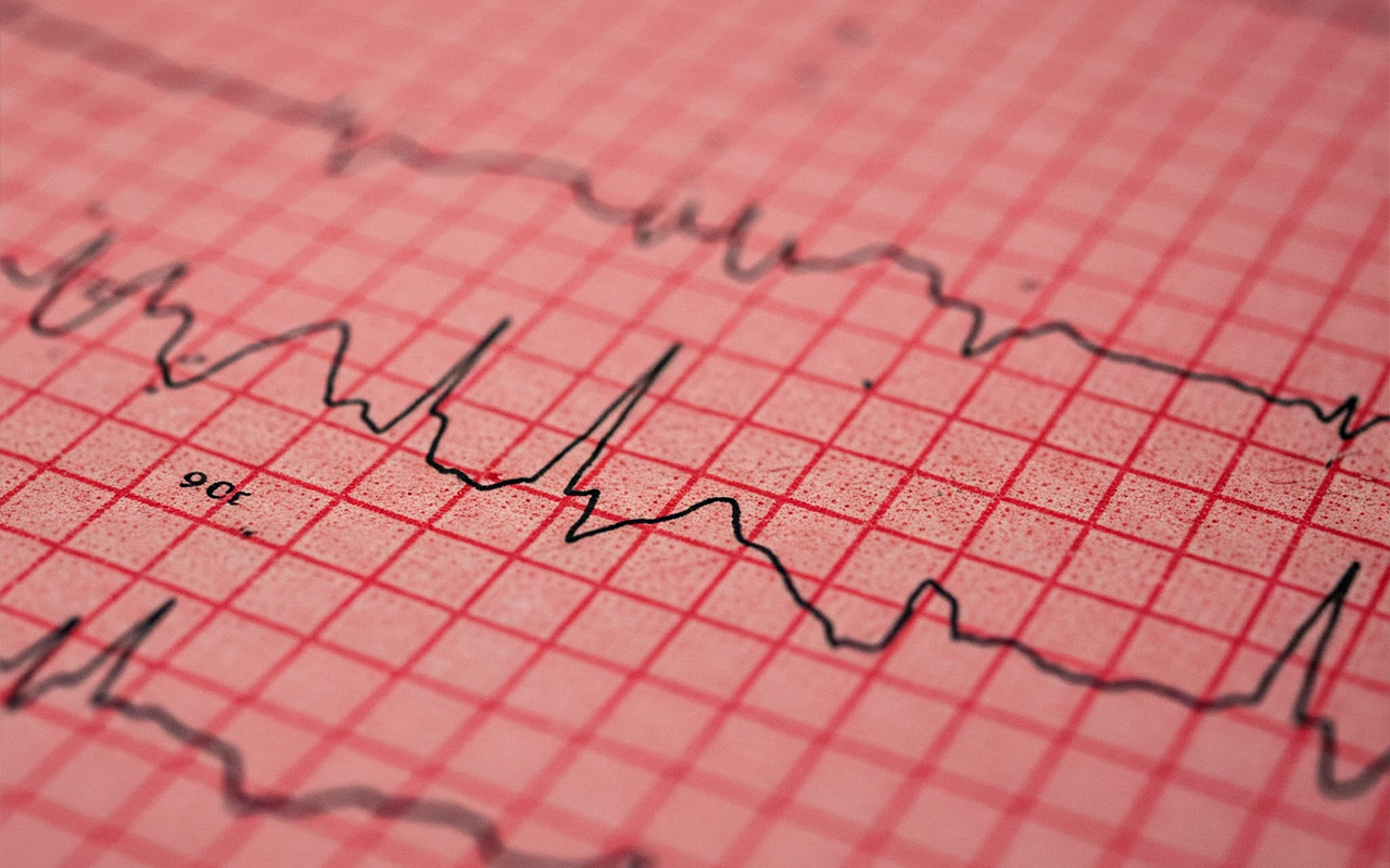 수면 무호흡 증.png