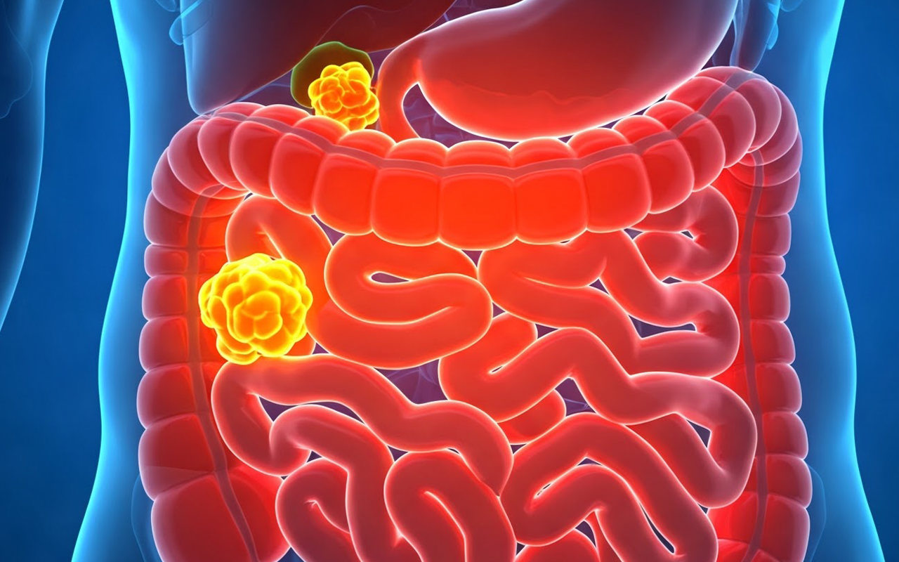 장기 암 사진 대장암.png