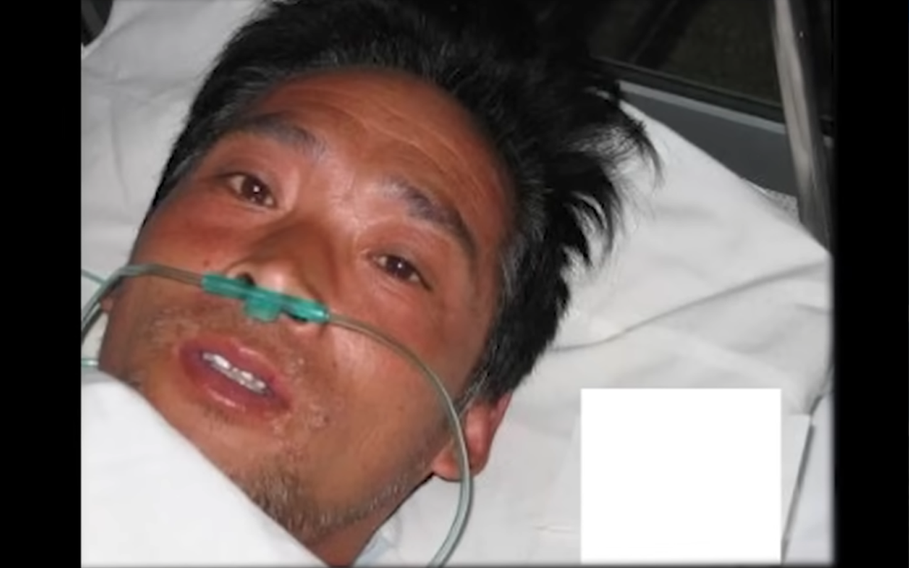 피폭 peaked interest1.png