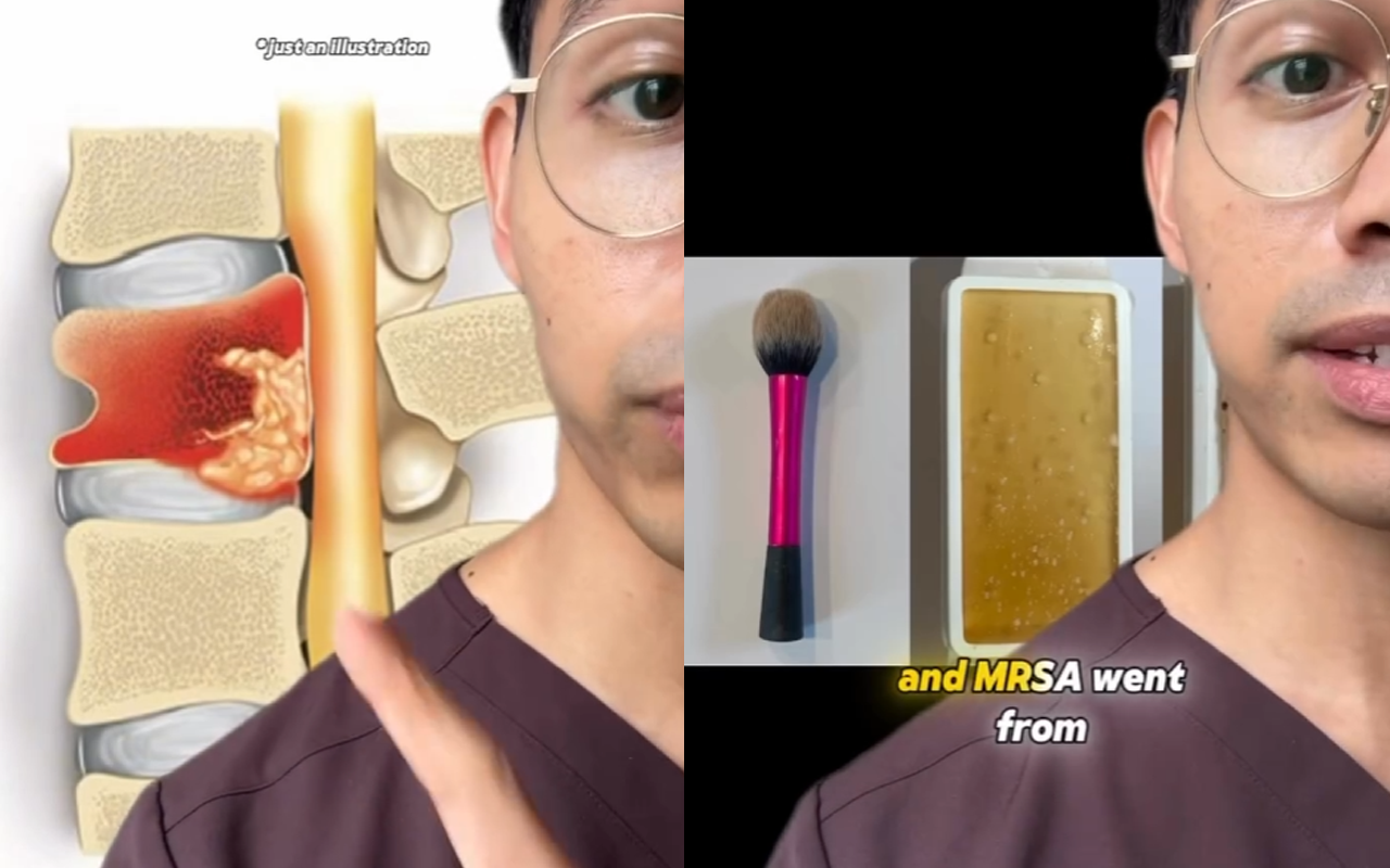 여드름 지우려다 휠체어1.png