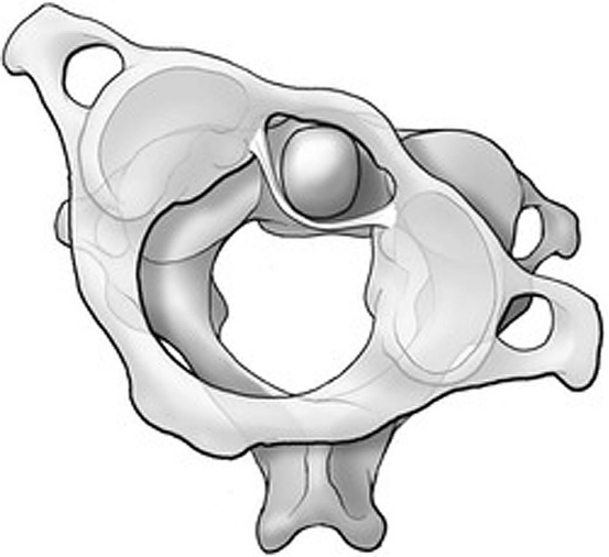 atlas displacement 01.png