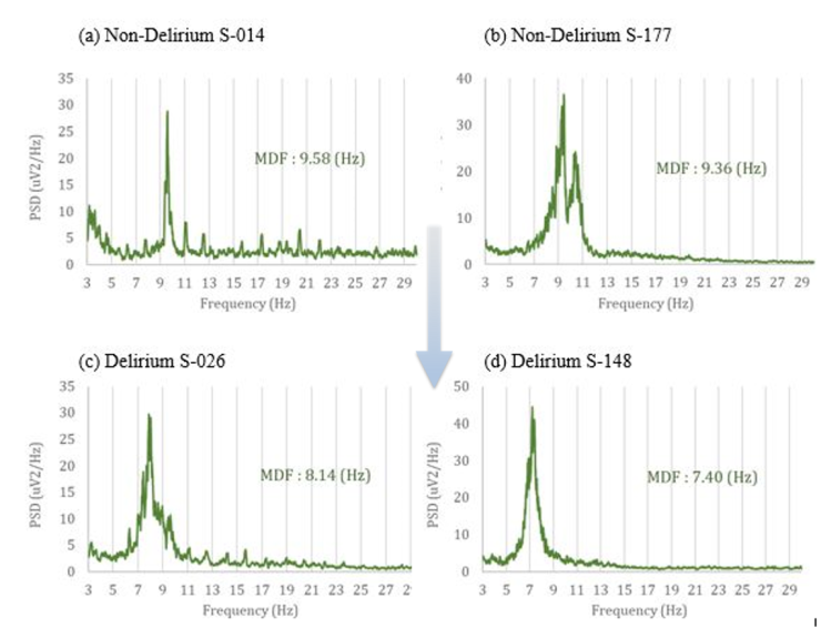 다운로드 (3).png