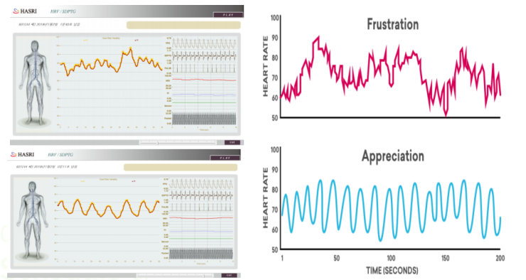 다운로드 (11).png