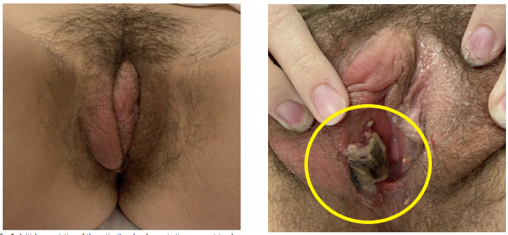 화면 캡처 2022-11-14 164414.png